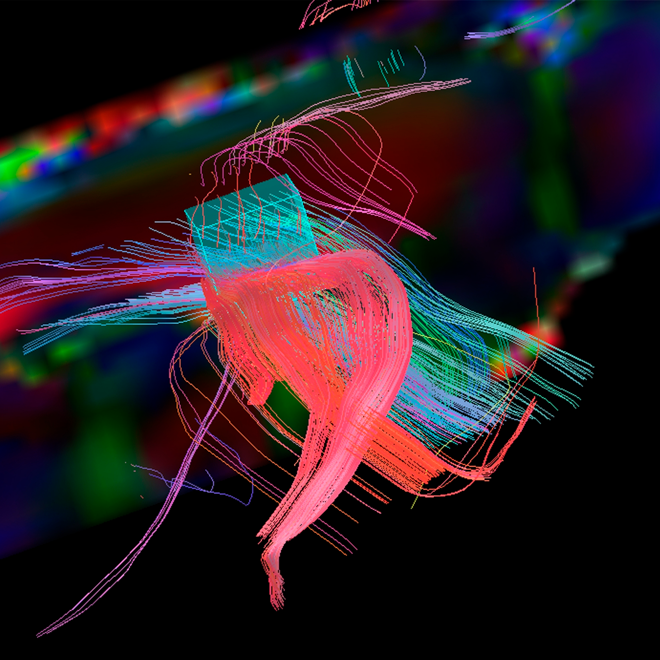 AI genererad bild